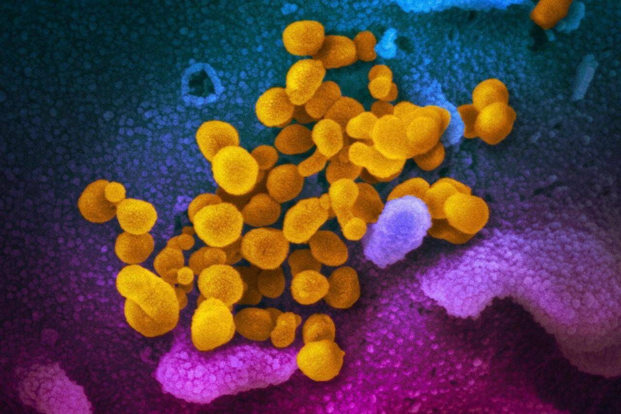 This undated electron microscope image made available by the U.S. National Institutes of Health in February 2020 shows the Novel Coronavirus SARS-CoV-2, yellow, emerging from the surface of cells, blue/pink, cultured in the lab. Also known as 2019-nCoV, the virus causes COVID-19. The sample was isolated from a patient in the U.S. Alberta’s oilsands are operating with critical staff only as the highly contagious Omicron variant sweeps the country. )THE CANADIAN PRESS/AP, NIAID-RML)